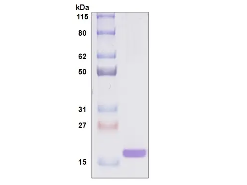 Recombinant Human Galectin 7, His Tag -100 ug